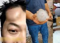 河北多地遭强对流天气:冰雹如拳