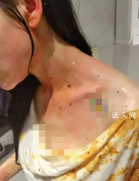 女主播遭家暴内脏破裂 丈夫被刑拘