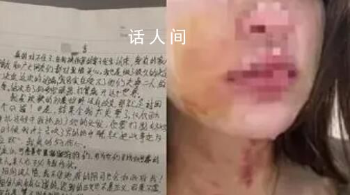 女子被夫妇殴打扒衣后吞安眠药自杀 送医后已抢救回来