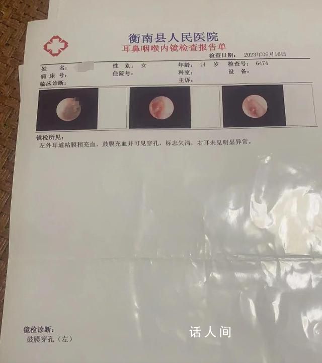 学生被老师掌掴耳膜穿孔?学校回应