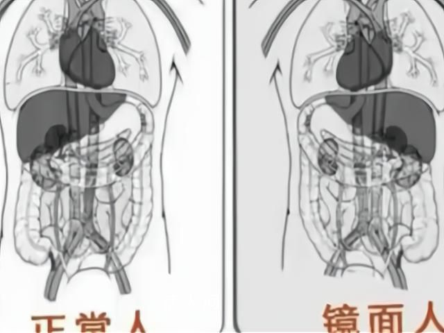 女子就医发现五脏六腑全长反 这种病例在全球的发生率仅为百万分之一