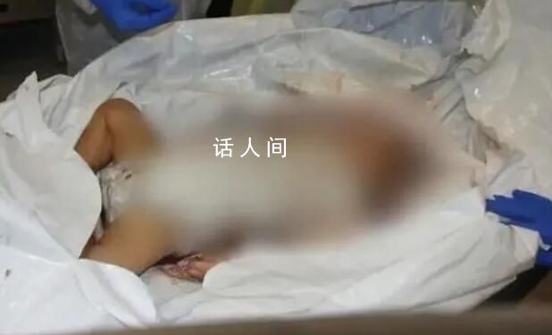 以色列公布婴儿遇害可怕照片 消息引发国际社会关注