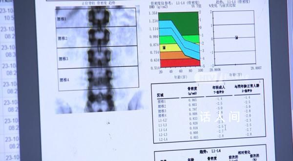 女子每天3杯咖啡被确诊骨质疏松 你喜欢喝咖啡吗