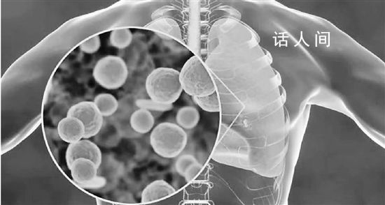 支原体肺炎今年为何如此“嚣张” 来势汹汹的常见病