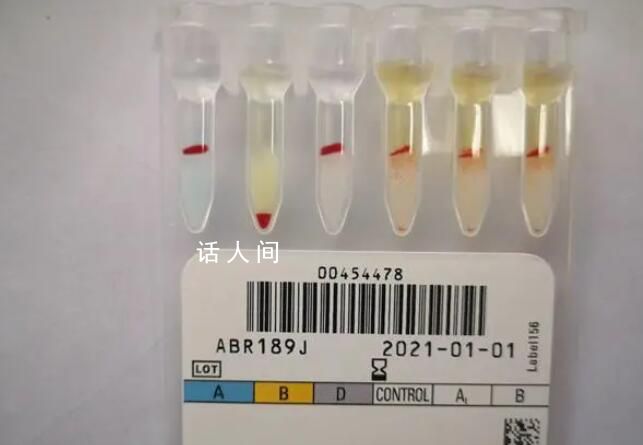 江苏泰州发现罕见小p血型 我国记录在案的小p血型仅有10余人