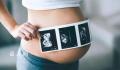 毛大庆建议在法治框架下放开代孕 改善人口生育率国家也应该给予立法支持