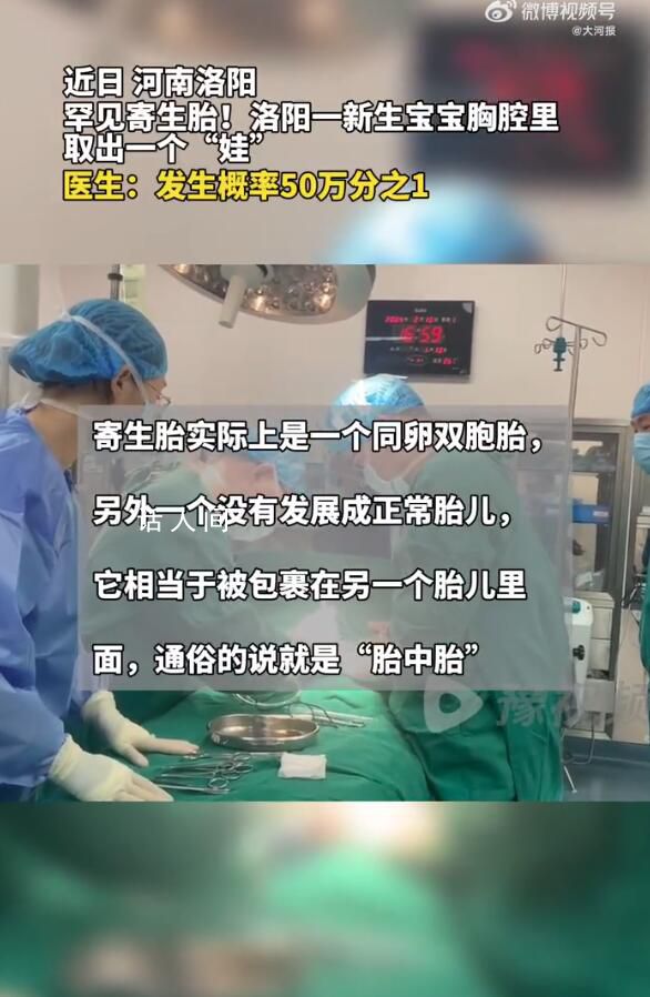 河南医生成功分离罕见胎中胎 手术后的男婴身体状况良好